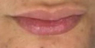 Avant Hydrafacial